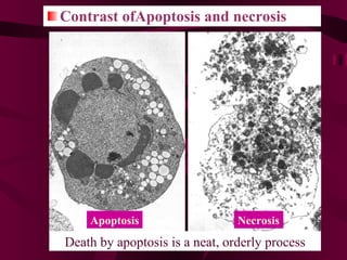 Contrast ofApoptosis and necrosis Apoptosis Necrosis Death by apoptosis is a neat, orderly process 