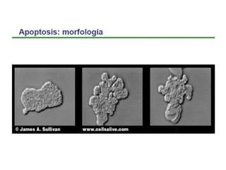 Apoptosis