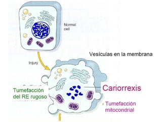 Apoptosis
