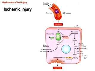 Mechanisms of Cell Injury


 Ischemic injury
 