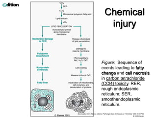 Chemical
                                      injury


                                Figure: Sequence of
                                events leading to fatty
                                change and cell necrosis
                                in carbon tetrachloride
                                (CCl4) toxicity. RER,
                                rough endoplasmic
                                reticulum; SER,
                                smoothendoplasmic
                                reticulum.
Downloaded from: Robbins & Cotran Pathologic Basis of Disease (on 19 October 2005 05:23 PM)
                                                                             © 2005 Elsevier
 