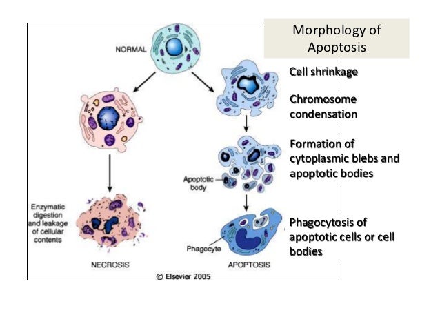 download imaging of kidney cancer