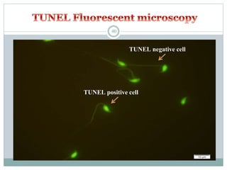 TUNEL positive cell
TUNEL negative cell
40
 