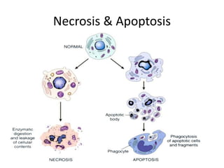 Necrosis & Apoptosis
 