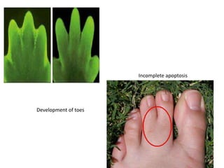 Development of toes
Incomplete apoptosis
 