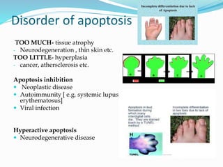 Disorder of apoptosis
TOO MUCH- tissue atrophy
- Neurodegeneration , thin skin etc.
TOO LITTLE- hyperplasia
- cancer, athersclerosis etc.
Apoptosis inhibition
 Neoplastic disease
 Autoimmunity [ e.g. systemic lupus
erythematosus]
 Viral infection
Hyperactive apoptosis
 Neurodegenerative disease
 