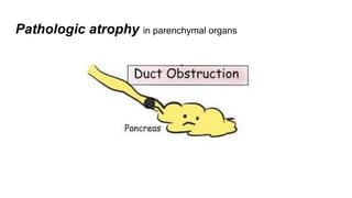 Pathologic atrophy in parenchymal organs
 