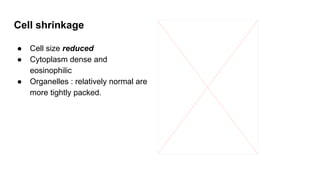 Cell shrinkage
● Cell size reduced
● Cytoplasm dense and
eosinophilic
● Organelles : relatively normal are
more tightly packed.
 