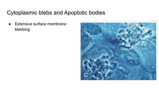 Cytoplasmic blebs and Apoptotic bodies
● Extensive surface membrane
blebbing
 