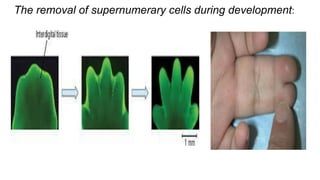 The removal of supernumerary cells during development:
 