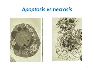 8
Apoptosis vs necrosis
 