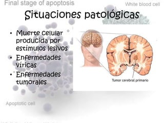 Situaciones patológicas
• Muerte celular
  producida por
  estímulos lesivos
• Enfermedades
  víricas
• Enfermedades
  tumorales
 