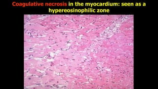 APOPTOSIS AND NECROSIS OF THE HUMAN BODY.pdf