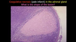 APOPTOSIS AND NECROSIS OF THE HUMAN BODY.pdf