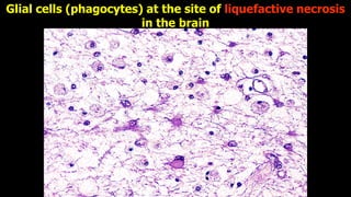APOPTOSIS AND NECROSIS OF THE HUMAN BODY.pdf
