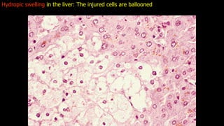 APOPTOSIS AND NECROSIS OF THE HUMAN BODY.pdf