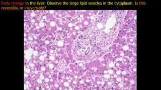 APOPTOSIS AND NECROSIS OF THE HUMAN BODY.pdf