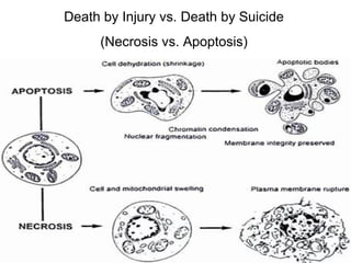 Death by Injury vs. Death by Suicide
(Necrosis vs. Apoptosis)
 