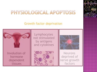 Growth factor deprivation
Involution of
hormone
dependent
tissues
Lymphocytes
not stimulated
by antigens
and cytokines
Neurons
deprived of
nerve growth
factors
 