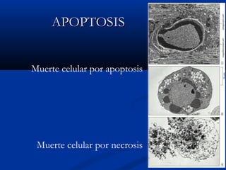 APOPTOSIS
Muerte celular por apoptosis

Muerte celular por necrosis

 
