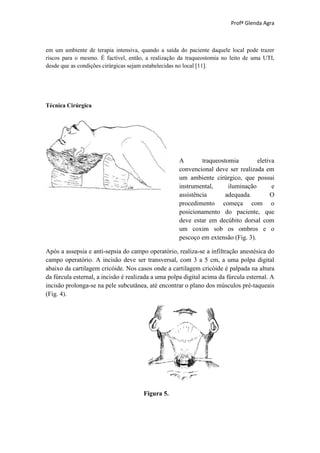 Profª Glenda Agra



em um ambiente de terapia intensiva, quando a saída do paciente daquele local pode trazer
riscos para o mesmo. É factível, então, a realização da traqueostomia no leito de uma UTI,
desde que as condições cirúrgicas sejam estabelecidas no local [11].




Técnica Cirúrgica




                                                     A        traqueostomia        eletiva
                                                     convencional deve ser realizada em
                                                     um ambiente cirúrgico, que possui
                                                     instrumental,      iluminação       e
                                                     assistência       adequada.        O
                                                     procedimento começa com o
                                                     posicionamento do paciente, que
                                                     deve estar em decúbito dorsal com
                                                     um coxim sob os ombros e o
                                                     pescoço em extensão (Fig. 3).

Após a assepsia e anti-sepsia do campo operatório, realiza-se a infiltração anestésica do
campo operatório. A incisão deve ser transversal, com 3 a 5 cm, a uma polpa digital
abaixo da cartilagem cricóide. Nos casos onde a cartilagem cricóide é palpada na altura
da fúrcula esternal, a incisão é realizada a uma polpa digital acima da fúrcula esternal. A
incisão prolonga-se na pele subcutânea, até encontrar o plano dos músculos pré-taqueais
(Fig. 4).




                                      Figura 5.
 