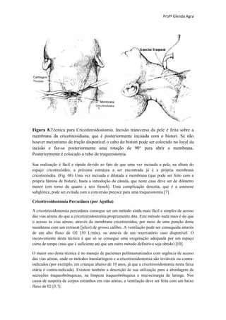 Profª Glenda Agra




Figura 8.Técnica para Cricotireoidostomia. Incisão transversa da pele é feita sobre a
membrana da cricotireoidiana, que é posteriormente incisada com o bisturi. Se não
houver mecanismo de tração disponível o cabo do bisturi pode ser colocado no local da
incisão e faz-se posteriormente uma rotação de 90° para abrir a membrana.
Posteriormente é colocado o tubo de traqueostomia.

Sua realização é fácil e rápida devido ao fato de que uma vez incisada a pele, na altura do
espaço cricotireóideo, a próxima estrutura a ser encontrada já é a própria membrana
cricotireóidea. (Fig. 08) Uma vez incisada e dilatada a membrana (que pode ser feito com a
própria lâmina de bisturi), basta a introdução da cânula, que neste caso deve ser de diâmetro
menor (em torno de quatro a seis french). Uma complicação descrita, que é a estenose
subglótica, pode ser evitada com a conversão precoce para uma traqueostomia [7].

Cricotireoidostomia Percutânea (por Agulha)

A cricotireoidostomia percutânea consegue ser um método ainda mais fácil e simples de acesso
das vias aéreas do que a cricotireoidostomia propriamente dita. Este método nada mais é do que
o acesso às vias aéreas, através da membrana cricotireóidea, por meio de uma punção desta
membrana com um extracat [jelco) de grosso calibre. A ventilação pode ser conseguida através
de um alto fluxo de O2 [10 L/min), ou através de um reservatório caso disponível. O
inconveniente desta técnica é que só se consegue uma oxigenação adequada por um espaço
curto de tempo (mas que é suficiente até que um outro método definitivo seja obtido) [10].

O maior uso desta técnica é no manejo de pacientes politraumatizados com urgência de acesso
das vias aéreas, onde os métodos translaríngeos e a cricotireoidostomia são inviáveis ou contra-
indicados (por exemplo, em crianças abaixo de 10 anos, já que a cricotireoidostomia nesta faixa
etária é contra-indicada). Existem também a descrição de sua utilização para a abordagem de
secreções traqueobrônquicas, na limpeza traqueobrônquica e microcirurgia de laringe. Nos
casos de suspeita de corpos estranhos em vias aéreas, a ventilação deve ser feita com um baixo
fluxo de 02 [3,7].
 