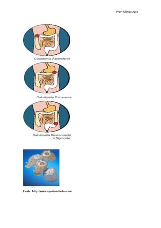 Profª Glenda Agra




Fonte: http://www.apostomizados.com
 
