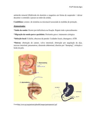 Profª Glenda Agra



antiácido mineral (Hidróxido de alumínio e magnésio em forma de suspensão = deixar
decantar o conteúdo e passar ao redor da sonda).

Candidíase: cremes de nistatina ou miconazol associada às medidas de proteção.

Jejunostomia:

*Saída da sonda: Ocorre por deficiência na fixação. Repete todo o procedimento.

*Migração da sonda para o peritônio: Peritonite grave: tratamento cirúrgico.

*Infecção local: Celulite, abscesso de parede: Cuidados locais, drenagem e ATB.

*Outras: obstrução do cateter, volvo intestinal, obstrução por angulação da alça,
necrose intestinal, pneumatose, distensão abdominal, diarréia por “dumping”, irritação e
lesão de pele.




Fontehttp://www.gi.org/patients/gihealth/images/gastroparesis1.gif
 