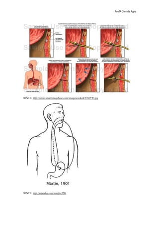 Profª Glenda Agra




FONTE: http://www.smartimagebase.com/imagescooked/27865W.jpg




FONTE: http://misodor.com/martin.JPG
 