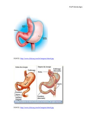 Profª Glenda Agra




FONTE: http://www.clinicaq.com.br/imagens/obes6.jpg




FONTE: http://www.clinicaq.com.br/imagens/obes6.jpg
 