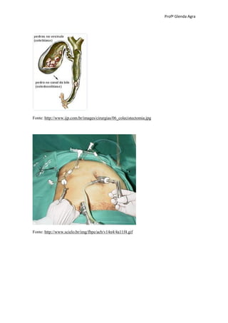 Profª Glenda Agra




Fonte: http://www.ijp.com.br/images/cirurgias/06_colecistectomia.jpg




Fonte: http://www.scielo.br/img/fbpe/acb/v14n4/4a11f4.gif
 