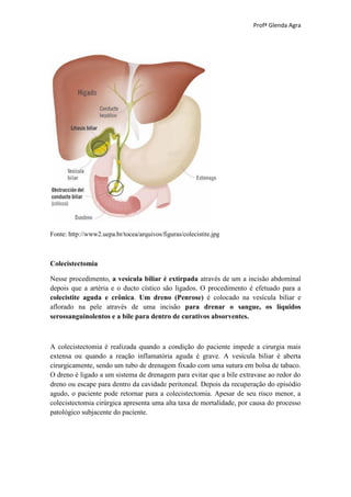 Profª Glenda Agra




Fonte: http://www2.uepa.br/tocea/arquivos/figuras/colecistite.jpg



Colecistectomia

Nesse procedimento, a vesícula biliar é extirpada através de um a incisão abdominal
depois que a artéria e o ducto cístico são ligados. O procedimento é efetuado para a
colecistite aguda e crônica. Um dreno (Penrose) é colocado na vesícula biliar e
aflorado na pele através de uma incisão para drenar o sangue, os líquidos
serossanguinolentos e a bile para dentro de curativos absorventes.



A colecistectomia é realizada quando a condição do paciente impede a cirurgia mais
extensa ou quando a reação inflamatória aguda é grave. A vesícula biliar é aberta
cirurgicamente, sendo um tubo de drenagem fixado com uma sutura em bolsa de tabaco.
O dreno é ligado a um sistema de drenagem para evitar que a bile extravase ao redor do
dreno ou escape para dentro da cavidade peritoneal. Depois da recuperação do episódio
agudo, o paciente pode retornar para a colecistectomia. Apesar de seu risco menor, a
colecistectomia cirúrgica apresenta uma alta taxa de mortalidade, por causa do processo
patológico subjacente do paciente.
 