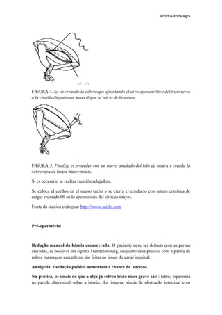 Profª Glenda Agra




FIGURA 4. Se va creando la sobrecapa afrontando el arco aponeurótico del transverso
a la cintilla iliopubiana hasta llegar al inicio de la sutura.




FIGURA 5. Finaliza el proceder con un nuevo anudado del hilo de sutura y creada la
sobrecapa de fascia transversalis.

Si es necesario se realiza incisión relajadora.

Se coloca el cordón en el nuevo lecho y se cierra el conducto con sutura continua de
catgut cromado 00 en la aponeurosis del oblicuo mayor.

Fonte da técnica cirúrgica: http://www.scielo.com



Pré-operatório:



Redução manual da hérnia encarcerada: O paciente deve ser deitado com as pernas
elevadas, se possível em ligeiro Trendelemburg, enquanto uma pressão com a palma da
mão e massagem ascendente são feitas ao longo do canal inguinal.

Analgesia e sedação prévias aumentam a chance do sucesso.

Na prática, os sinais de que a alça já sofreu lesão mais grave são : febre, hiperemia
na parede abdominal sobre a hérnia, dor intensa, sinais de obstrução intestinal com
 