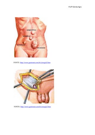 Profª Glenda Agra




FONTE: http://www.gastronet.com.br/cirurgia3.htm




FONTE: http://www.gastronet.com.br/cirurgia3.htm
 