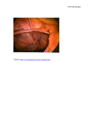 Profª Glenda Agra




FONTE: http://www.gastronet.com.br/cirurgia3.htm
 