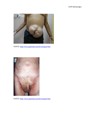 Profª Glenda Agra




FONTE: http://www.gastronet.com.br/cirurgia3.htm




FONTE: http://www.gastronet.com.br/cirurgia3.htm
 