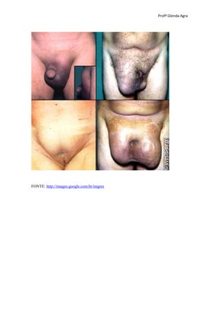 Profª Glenda Agra




FONTE: http://images.google.com.br/imgres
 