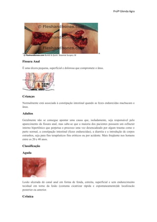 Profª Glenda Agra




Fissura Anal

É uma úlcera pequena, superficial e dolorosa que compromete o ânus.




Crianças

Normalmente está associada à constipação intestinal quando as fezes endurecidas machucam o
ânus.

Adultos

Geralmente não se consegue apontar uma causa que, isoladamente, seja responsável pelo
aparecimento da fissura anal, mas sabe-se que a maioria dos pacientes possuem um esfíncter
interno hipertônico que perpetua o processo uma vez desencadeado por algum trauma como o
parto normal, a constipação intestinal (fezes endurecidas), a diarréia e a introdução de corpos
estranhos, seja para fins terapêuticos fins eróticos ou por acidente. Mais freqüente nos homens
entre os 20 e 40 anos.

Classificação

Aguda




Lesão ulcerada do canal anal em forma de fenda, estreita, superficial e sem endurecimento
tecidual em torno da lesão (costuma cicatrizar rápida e espontaneamente)de localizacão
posterior ou anterior.

Crônica
 