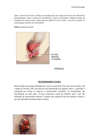 Profª Glenda Agra



Após o advento da ELIS os índices de complicações da cirurgia da fissura anal diminuíram
acentuadamente. Graus variados de incontinência, comuns nos métodos cirúrgicos antigos de
tratamento de fissuras anais, caíram para em média 6% com a ELIS, e, com ela, em geral, só
ocorrem graus menores de incontinência.

Fonte: itmedicina.med.br




                              HEMORROIDECTOMIA

Hemorróidas são porções dilatadas das veias no canal anal. Elas são muito comuns. Até
a idade de 50 anos, 50% das pessoas têm hemorróidas de alguma forma. A gravidez é
conhecida por iniciar ou agravar as hemorróidas existentes. As hemorróidas são
classificadas em dois tipos. As que acontecem acima do esfíncter anal e que são
chamadas de hemorróidas internas, e aquelas que aparecem fora do esfíncter externo e
que são chamadas de hemorróidas externas.
 