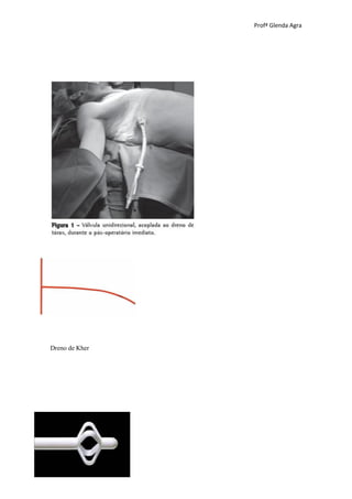 Profª Glenda Agra




Dreno de Kher
 