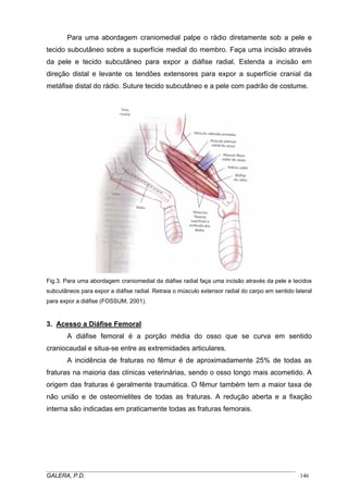 Para uma abordagem craniomedial palpe o rádio diretamente sob a pele e
tecido subcutâneo sobre a superfície medial do membro. Faça uma incisão através
da pele e tecido subcutâneo para expor a diáfise radial. Estenda a incisão em
direção distal e levante os tendões extensores para expor a superfície cranial da
metáfise distal do rádio. Suture tecido subcutâneo e a pele com padrão de costume.

Fig.3. Para uma abordagem craniomedial da diáfise radial faça uma incisão através da pele e tecidos
subcutâneos para expor a diáfise radial. Retraia o músculo extensor radial do carpo em sentido lateral
para expor a diáfise (FOSSUM, 2001).

3. Acesso a Diáfise Femoral
A diáfise femoral é a porção média do osso que se curva em sentido
craniocaudal e situa-se entre as extremidades articulares.
A incidência de fraturas no fêmur é de aproximadamente 25% de todas as
fraturas na maioria das clínicas veterinárias, sendo o osso longo mais acometido. A
origem das fraturas é geralmente traumática. O fêmur também tem a maior taxa de
não união e de osteomielites de todas as fraturas. A redução aberta e a fixação
interna são indicadas em praticamente todas as fraturas femorais.

_____________________________________________________________________________________
GALERA, P.D.
146

 