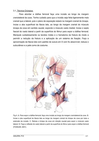 3.1. Técnica Cirúrgica:
Para abordar a diáfise femoral faça uma incisão ao longo da margem
craniolateral da coxa. Tenha cuidado para que a incisão seja feita ligeiramente mais
cranial que a lateral, pois o plano de exposição estará na margem cranial do bíceps.
Incise a aba superficial da fáscia lata, ao longo da margem cranial do músculo
bíceps da coxa em sentido caudal, expondo o músculo vasto medial. Incise o septo
fascial do vasto lateral a partir da superfície do fêmur para expor a diáfise femoral.
Manipule cuidadosamente os tecidos moles e o hematoma da fratura de modo a
permitir a redução da fratura e a aplicação de um sistema de fixação. Faça a
aproximação da fáscia lata com padrão de sutura em X com fio absorvível, reduza o
subcutâneo e a pele como de costume.

Fig.4. A. Para expor a diáfise femoral, faça uma incisão ao longo da margem craniolateral da coxa. B.
Incise a aba superficial da fáscia lata ao longo da margem cranial do bíceps da coxa por toda a
extensão da incisão. C. Retraia o bíceps da coxa em direção caudal para expor o músculo vasto
lateral. D. Faça a reflexão do vasto lateral a partir da superfície do fêmur para expor a diáfise femoral
(FOSSUM, 2001).

_____________________________________________________________________________________
GALERA, P.D.
147

 