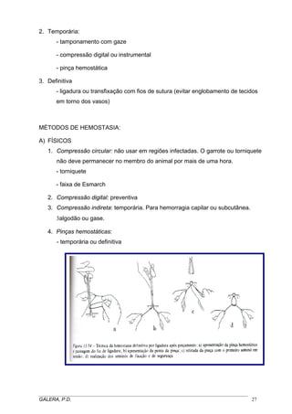 2. Temporária:
- tamponamento com gaze
- compressão digital ou instrumental
- pinça hemostática
3. Definitiva
- ligadura ou transfixação com fios de sutura (evitar englobamento de tecidos
em torno dos vasos)

MÉTODOS DE HEMOSTASIA:
A) FÍSICOS
1. Compressão circular: não usar em regiões infectadas. O garrote ou torniquete
não deve permanecer no membro do animal por mais de uma hora.
- torniquete
- faixa de Esmarch
2. Compressão digital: preventiva
3. Compressão indireta: temporária. Para hemorragia capilar ou subcutânea.
3algodão ou gase.
4. Pinças hemostáticas:
- temporária ou definitiva

_____________________________________________________________________________________
GALERA, P.D.
27

 