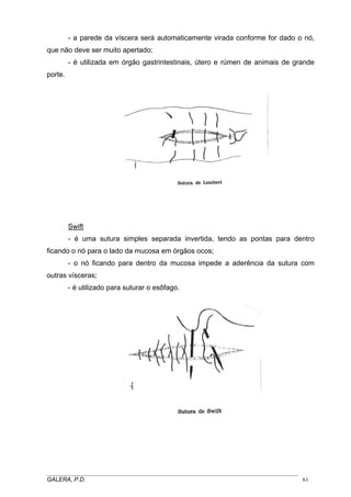 - a parede da víscera será automaticamente virada conforme for dado o nó,
que não deve ser muito apertado;
- é utilizada em órgão gastrintestinais, útero e rúmen de animais de grande
porte.

Swift
- é uma sutura simples separada invertida, tendo as pontas para dentro
ficando o nó para o lado da mucosa em órgãos ocos;
- o nó ficando para dentro da mucosa impede a aderência da sutura com
outras vísceras;
- é utilizado para suturar o esôfago.

_____________________________________________________________________________________
GALERA, P.D.
61

 