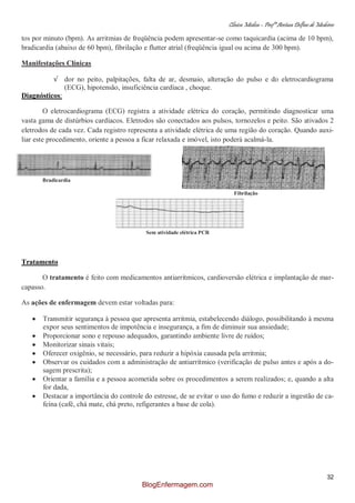 Clínica Médica – Profª Aretusa Delfino de Medeiros
32
tos por minuto (bpm). As arritmias de freqüência podem apresentar-se como taquicardia (acima de 10 bpm),
bradicardia (abaixo de 60 bpm), fibrilação e flutter atrial (freqüência igual ou acima de 300 bpm).
Manifestações Clínicas
√ dor no peito, palpitações, falta de ar, desmaio, alteração do pulso e do eletrocardiograma
(ECG), hipotensão, insuficiência cardíaca , choque.
Diagnósticos:
O eletrocardiograma (ECG) registra a atividade elétrica do coração, permitindo diagnosticar uma
vasta gama de distúrbios cardíacos. Eletrodos são conectados aos pulsos, tornozelos e peito. São ativados 2
eletrodos de cada vez. Cada registro representa a atividade elétrica de uma região do coração. Quando auxi-
liar este procedimento, oriente a pessoa a ficar relaxada e imóvel, isto poderá acalmá-la.
Bradicardia
Fibrilação
Sem atividade elétrica PCR
Tratamento
O tratamento é feito com medicamentos antiarrítmicos, cardioversão elétrica e implantação de mar-
capasso.
As ações de enfermagem devem estar voltadas para:
Transmitir segurança à pessoa que apresenta arritmia, estabelecendo diálogo, possibilitando à mesma
expor seus sentimentos de impotência e insegurança, a fim de diminuir sua ansiedade;
Proporcionar sono e repouso adequados, garantindo ambiente livre de ruídos;
Monitorizar sinais vitais;
Oferecer oxigênio, se necessário, para reduzir a hipóxia causada pela arritmia;
Observar os cuidados com a administração de antiarrítmico (verificação de pulso antes e após a do-
sagem prescrita);
Orientar a família e a pessoa acometida sobre os procedimentos a serem realizados; e, quando a alta
for dada,
Destacar a importância do controle do estresse, de se evitar o uso do fumo e reduzir a ingestão de ca-
feína (café, chá mate, chá preto, refigerantes a base de cola).
BlogEnfermagem.com
 