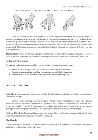 Clínica Médica – Profª Aretusa Delfino de Medeiros
85
1- desvio dos dedos 2-dedos em martelo 3-dedos em colo de cisne
A artrite reumatóide pode causar um pouco de febre e, em algumas ocasiões, uma inflamação dos va-
sos sanguíneos (vasculite), que provoca lesões dos nervos ou chagas nas pernas (úlceras). A inflamação das
membranas que envolvem os pulmões (pleurisia) ou do invólucro do coração (pericardite), ou então a infla-
mação e as cicatrizes dos pulmões podem provocar dor torácica, dificuldade em respirar e uma função cardí-
aca anormal. Algumas pessoas desenvolvem gânglios linfáticos inflamados, a síndroma de Sjögren ou uma
inflamação ocular.
Tratamento: Consiste em dissipar o processo inflamatório, prevenir deformidades e corrigir as já existen-
tes; Analgésicos, corticóides,miorelaxantes, fisioterapia, massagens, exercícios físicos ativos e passivos
Cuidados de Enfermagem:
As ações de enfermagem desenvolvidas com um portador de doença reumática visam:
Aliviar a dor articular por meio da administração de analgésicos prescritos;
Orientar a manutenção de equilíbrio entre repouso e as atividades da pessoa;
Incentivar dieta rica em carboidratos e proteínas e a ingestão de líquidos.
LÚPUS ERITEMATOSO
Definição: é uma doença auto-imune com episódios de inflamação nas articulações, tendões e outros tecidos
conjuntivos e órgãos.
Verifica-se uma inflamação de diversos tecidos e órgãos numa diversidade de pessoas, indo o grau da
doença de ligeiro a debilitante, dependendo da quantidade e da variedade de anticorpos que aparecem e dos
órgãos interessados. Cerca de 90 % das pessoas com lúpus são mulheres dos 20 aos 30 anos; mas também
pode aparecer em crianças (sobretudo de sexo feminino), homens e mulheres de idade avançada.
Etiologia: Não são totalmente conhecidas, mas sabe-se que fatores ambientai e genéticos estão envolvidos (
infecções, medicamentos,exposição a raios UV e estresse)
Classificação:
Lúpus Eritematoso Discóide(LED): Quase sempre limitado a pele. É identificado por inflamações cutâneas
que aparece na face, nuca e couro cabeludo.
BlogEnfermagem.com
 