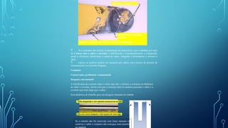  Se o operador não realizar a manutenção do material de corte e trabalhar por mais
de 2 horas com o sabre e corrente, a lubrificação e consequentemente a refrigeração
perde a eficiência, danificando a ponta do sabre, chegando a destemperar e derreter o
sabre.
 Lascas ou quebras podem ser causados por sabres com excesso de pressão de
tensionamento ou correntes folgadas.
Canaletas
Conservação, problemas e manutenção
Desgaste convencional
A lubrificação da corrente reduz o atrito mas não o elimina, a estrutura ou dinâmica
do sabre e corrente, fazem com que a corrente entre na madeira puxando o sabre e a
corrente seja mais larga que o sabre.
Essa dinâmica de trabalho gera um desgaste chamado de rebarba
Manchas e Lascas
Queima provocada pelo
pinhão
Queima + Abertura da canaleta = Corrente pressionada
Se a rebarba não for removida com limas manuais ou
rotativas o sabre o conjunto não consegue mais penetrar
na madeira.
 