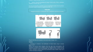 adequada. Troque a corrente. (FIG. 10)
F. Rebaixe a guia de profundidade até atingir a altura correta. Utilize o calibrador
adequado à corrente. (FIG. 11)
G. Com uma lima plana, arredondar a guia de profundidade tentando deixá-la próxima
do desenho original, conforme era quando nova. (FIG. 12)
Desgastes das bases dos cortadores e dos elos de união. Solução: Ver J.
Soluções:
H.Substitua os cortadores e elos danificados. Se forem muitos, troque a corrente.
(FIG. 13 e 14)
NOTA: Para prevenir futuros desgastes deste tipo, sigas estas recomendações: Afie
novamente os cortadores com os ângulos corretos; lubrifique melhor o conjunto de corte;
calibrar corretamente as guias de profundidade; não trabalhe com uma corrente sem corte
(“cega”); mantenha a corrente sempre bem (corretamente) afiada; trabalhe sempre com a
corrente tensionada corretamente.
PROBLEMA
Desgaste excessivo e rompimento dos cortadores e elos das correntes.
 