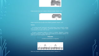 Golpes na parte frontal dos cortadores e dos elos de união. Solução: ver Q.
Região central dos elos de união e dos cortadores golpeadas. Solução: ver R.
Soluções:
Q.A corrente travada (“junta presa”) não se pode reparar. Troque a corrente, verifique
se há necessidade de trocar também a transmissão (pinhão/coroa) e cheque sempre
o tensionamento da corrente. (FIG. 24 e 25).
R.Troque a transmissão (pinhão ou coroa) e a corrente. Mantenha a corrente
tensionada corretamente e nunca submeta uma corrente nova ao trabalho conjunto com
pinhão ou coroa muito desgastado. (FIG. 26).
Danos nos cortadores somente em um lado da corrente. Solução ver S.
PROBLEMA
Cortadores danificados ou irregulares
 