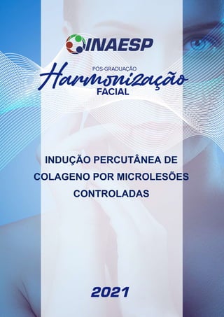 www.inaesp.com.br
1
INDUÇÃO PERCUTÂNEA DE
COLAGENO POR MICROLESÕES
CONTROLADAS
 